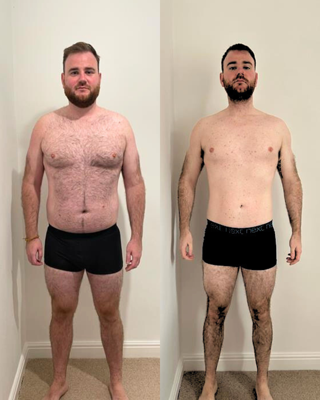 Civilian transformation