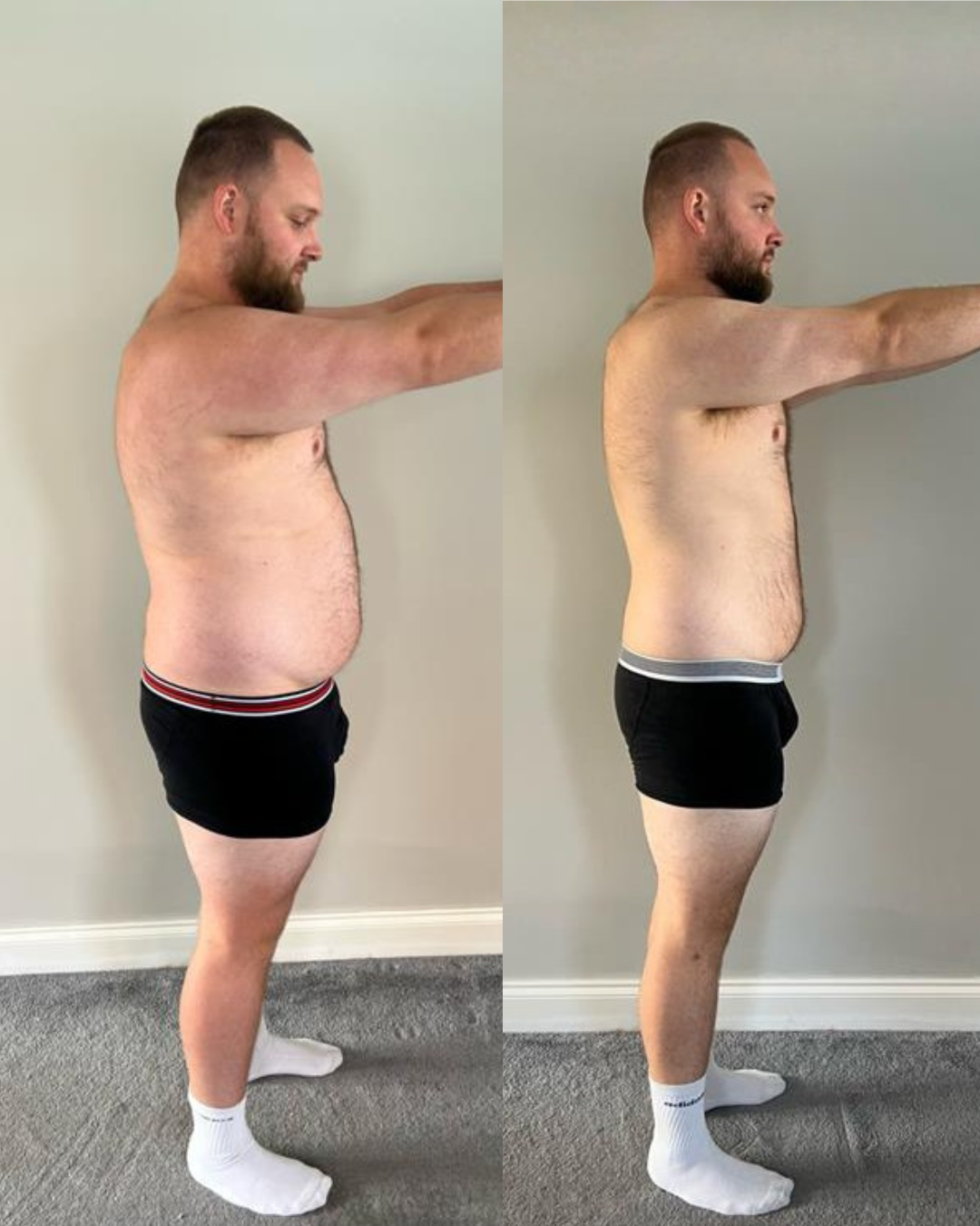 Civilian transformation